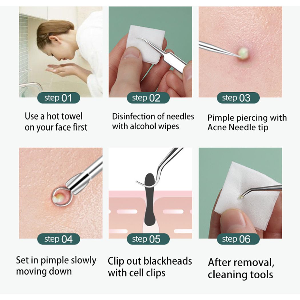 Henvivi™ Professional Stainless Steel Blackhead Acne Removal