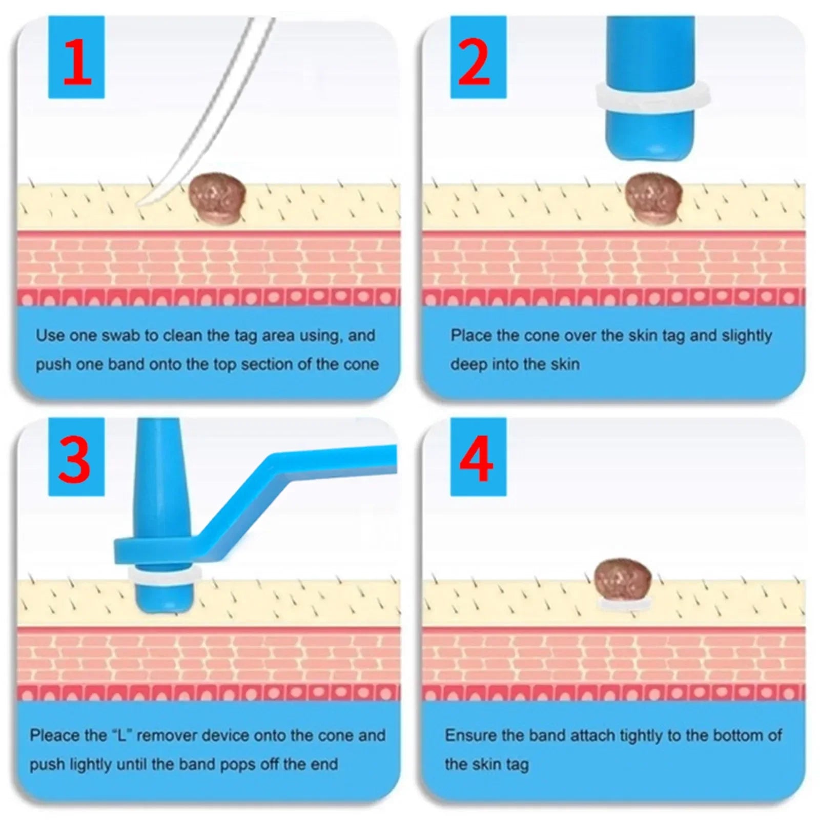 Henvivi™ Tagaway Bands – Piece Refill Box