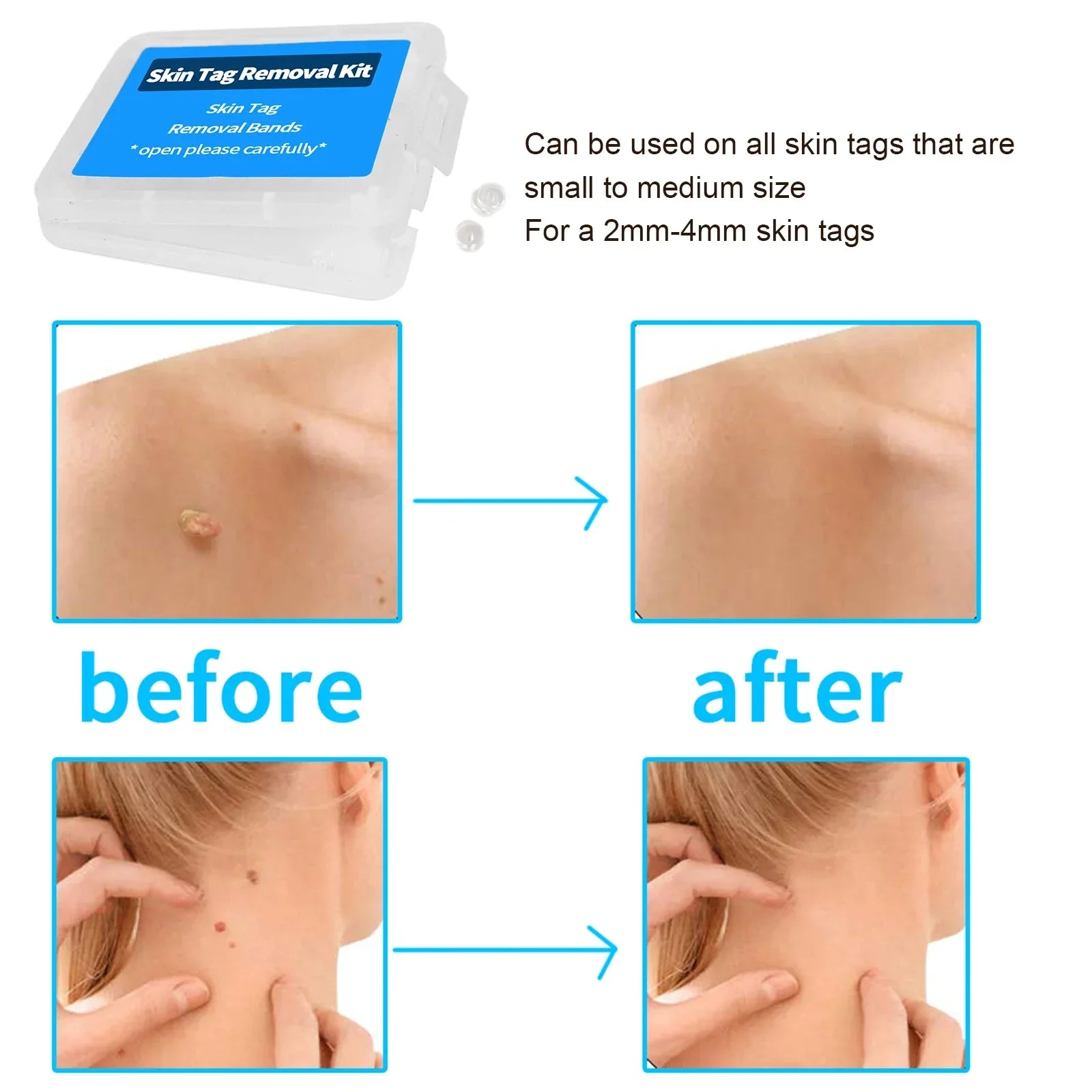 Henvivi™ Tagaway Bands – Piece Refill Box