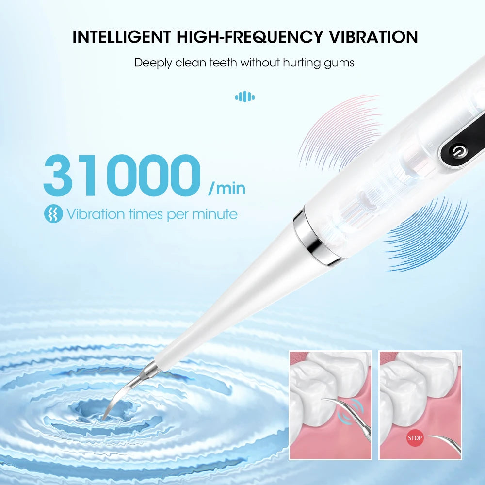 Henvivi™ Teeth Cleaner Dental Scaler Waterproof Oral