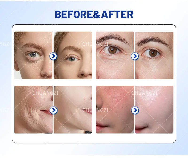 Henvivi™ Slimming Dcool Cool Tightening Anti Facial