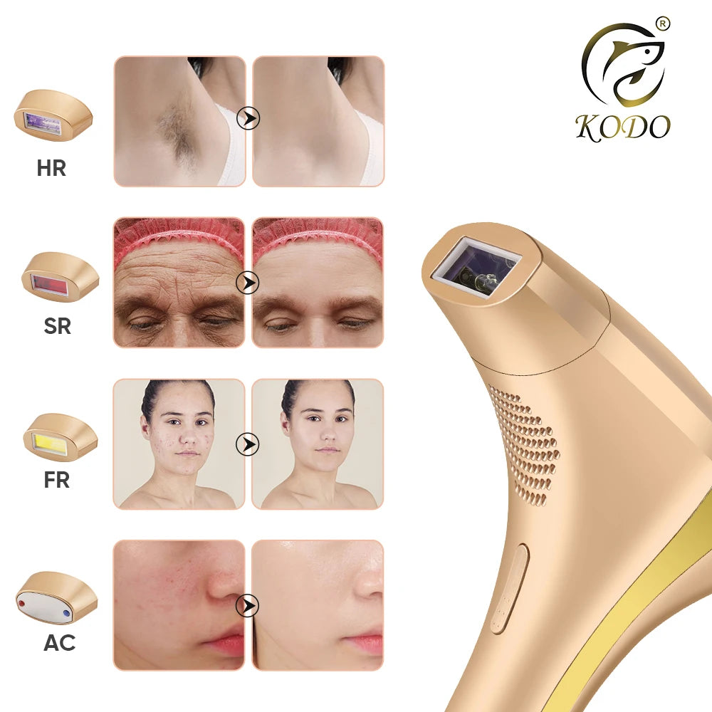 Henvivi™ Kodo High End Customization Ice Laser