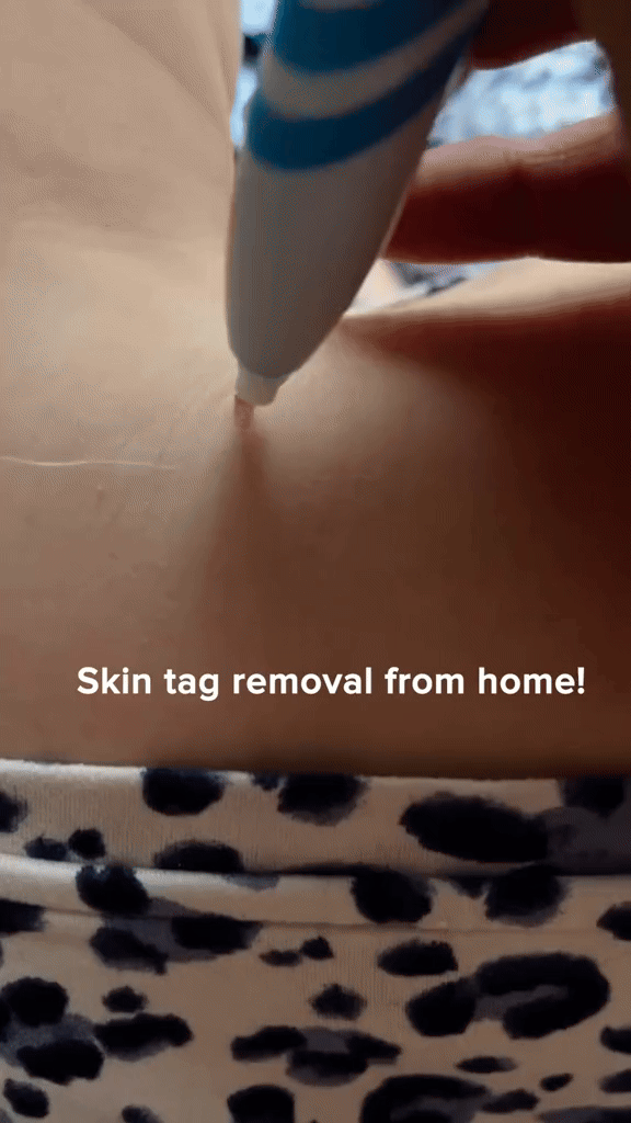Henvivi™ Tagaway Kit – Remove Up Tags